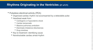Copyright
©
2023
by
Jones
&
Bartlett
Learning,
LLC,
an
Ascend
Learning
Company
and
the
American
Academy
of
Orthopaedic
Surgeons.
Rhythms Originating in the Ventricles (21 of 21)
 Pulseless electrical activity (PEA)
 Organized cardiac rhythm not accompanied by a detectable pulse
 Heartbeat weak from:
 Cardiogenic or hypovolemic shock
 Cardiac tamponade
 Massive pulmonary embolism
 Electrolyte imbalance disturbances
 Drug overdose
 Key to treatment: identifying cause
 Nonshockable cardiac arrest rhythm
 