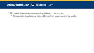 Copyright
©
2023
by
Jones
&
Bartlett
Learning,
LLC,
an
Ascend
Learning
Company
and
the
American
Academy
of
Orthopaedic
Surgeons.
Atrioventricular (AV) Blocks (1 of 7)
 SA node initiates impulses resulting in heart contractions.
 Occasionally, impulses are delayed longer than usual, causing AV blocks.
 