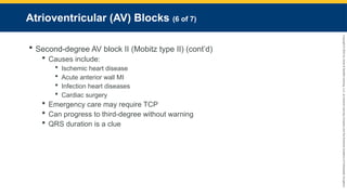 Copyright
©
2023
by
Jones
&
Bartlett
Learning,
LLC,
an
Ascend
Learning
Company
and
the
American
Academy
of
Orthopaedic
Surgeons.
Atrioventricular (AV) Blocks (6 of 7)
 Second-degree AV block II (Mobitz type II) (cont’d)
 Causes include:
 Ischemic heart disease
 Acute anterior wall MI
 Infection heart diseases
 Cardiac surgery
 Emergency care may require TCP
 Can progress to third-degree without warning
 QRS duration is a clue
 