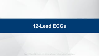 Copyright © 2023 by Jones & Bartlett Learning, LLC, an Ascend Learning Company and the American Academy of Orthopaedic Surgeons.
12-Lead ECGs
 