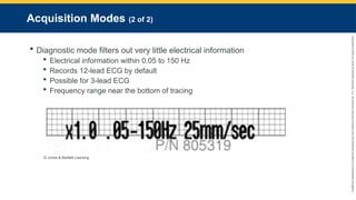 Copyright
©
2023
by
Jones
&
Bartlett
Learning,
LLC,
an
Ascend
Learning
Company
and
the
American
Academy
of
Orthopaedic
Surgeons.
Acquisition Modes (2 of 2)
 Diagnostic mode filters out very little electrical information
 Electrical information within 0.05 to 150 Hz
 Records 12-lead ECG by default
 Possible for 3-lead ECG
 Frequency range near the bottom of tracing
© Jones & Bartlett Learning
 