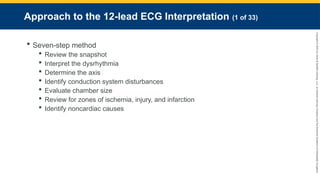 Copyright
©
2023
by
Jones
&
Bartlett
Learning,
LLC,
an
Ascend
Learning
Company
and
the
American
Academy
of
Orthopaedic
Surgeons.
Approach to the 12-lead ECG Interpretation (1 of 33)
 Seven-step method
 Review the snapshot
 Interpret the dysrhythmia
 Determine the axis
 Identify conduction system disturbances
 Evaluate chamber size
 Review for zones of ischemia, injury, and infarction
 Identify noncardiac causes
 