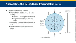 Copyright
©
2023
by
Jones
&
Bartlett
Learning,
LLC,
an
Ascend
Learning
Company
and
the
American
Academy
of
Orthopaedic
Surgeons.
Approach to the 12-lead ECG Interpretation (6 of 33)
 Determine the axis (cont’d)
 Viewed from lead aVF, QRS wave
will be:
 Positive if heading toward the feet
 Negative if heading toward the
head
 Quadrant system determines QRS
axis
 Intersection represents impulse
origin
© Jones & Bartlett Learning.
 