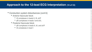 Copyright
©
2023
by
Jones
&
Bartlett
Learning,
LLC,
an
Ascend
Learning
Company
and
the
American
Academy
of
Orthopaedic
Surgeons.
Approach to the 12-lead ECG Interpretation (10 of 33)
 Conduction system disturbances (cont’d)
 Anterior fascicular block
 rS complexes in leads II, III, aVF
 qR complexes in leads I and aVL
 Posterior fascicular block
 qR complexes in leads II, III, and aVF
 rS complexes in lead I
 