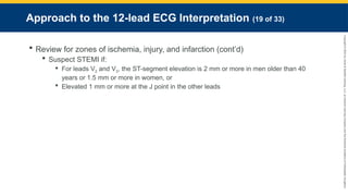 Copyright
©
2023
by
Jones
&
Bartlett
Learning,
LLC,
an
Ascend
Learning
Company
and
the
American
Academy
of
Orthopaedic
Surgeons.
Approach to the 12-lead ECG Interpretation (19 of 33)
 Review for zones of ischemia, injury, and infarction (cont’d)
 Suspect STEMI if:
 For leads V2 and V3, the ST-segment elevation is 2 mm or more in men older than 40
years or 1.5 mm or more in women, or
 Elevated 1 mm or more at the J point in the other leads
 