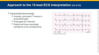 Copyright
©
2023
by
Jones
&
Bartlett
Learning,
LLC,
an
Ascend
Learning
Company
and
the
American
Academy
of
Orthopaedic
Surgeons.
Approach to the 12-lead ECG Interpretation (33 of 33)
 Intracranial hemorrhage
 Inverted, symmetric T waves in
precordial leads
 Prolonged QT intervals
 Patient will have neurologic
symptoms or be unresponsive
© Jones & Bartlett Learning.
 