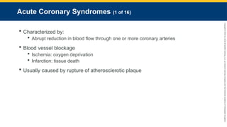 Copyright
©
2023
by
Jones
&
Bartlett
Learning,
LLC,
an
Ascend
Learning
Company
and
the
American
Academy
of
Orthopaedic
Surgeons.
Acute Coronary Syndromes (1 of 16)
 Characterized by:
 Abrupt reduction in blood flow through one or more coronary arteries
 Blood vessel blockage
 Ischemia: oxygen deprivation
 Infarction: tissue death
 Usually caused by rupture of atherosclerotic plaque
 
