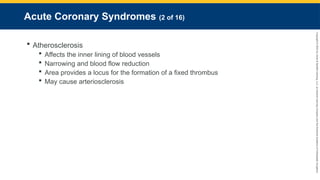 Copyright
©
2023
by
Jones
&
Bartlett
Learning,
LLC,
an
Ascend
Learning
Company
and
the
American
Academy
of
Orthopaedic
Surgeons.
Acute Coronary Syndromes (2 of 16)
 Atherosclerosis
 Affects the inner lining of blood vessels
 Narrowing and blood flow reduction
 Area provides a locus for the formation of a fixed thrombus
 May cause arteriosclerosis
 