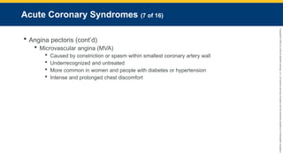 Copyright
©
2023
by
Jones
&
Bartlett
Learning,
LLC,
an
Ascend
Learning
Company
and
the
American
Academy
of
Orthopaedic
Surgeons.
Acute Coronary Syndromes (7 of 16)
 Angina pectoris (cont’d)
 Microvascular angina (MVA)
 Caused by constriction or spasm within smallest coronary artery wall
 Underrecognized and untreated
 More common in women and people with diabetes or hypertension
 Intense and prolonged chest discomfort
 
