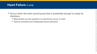Copyright
©
2023
by
Jones
&
Bartlett
Learning,
LLC,
an
Ascend
Learning
Company
and
the
American
Academy
of
Orthopaedic
Surgeons.
Heart Failure (1 of 6)
 Occurs when the heart cannot pump fast or powerfully enough to empty its
chambers
 Blood backs up into systemic or pulmonary circuit, or both
 Volume overload and inadequate tissue perfusion
 