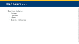 Copyright
©
2023
by
Jones
&
Bartlett
Learning,
LLC,
an
Ascend
Learning
Company
and
the
American
Academy
of
Orthopaedic
Surgeons.
Heart Failure (2 of 6)
 Common features
 Fatigue
 Dyspnea
 Edema
 Exercise intolerance
 