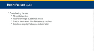 Copyright
©
2023
by
Jones
&
Bartlett
Learning,
LLC,
an
Ascend
Learning
Company
and
the
American
Academy
of
Orthopaedic
Surgeons.
Heart Failure (4 of 6)
 Contributing factors
 Thyroid disorders
 Alcohol or illegal substance abuse
 Cancer treatments that damage myocardium
 Infectious agents that cause inflammation
 