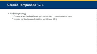 Copyright
©
2023
by
Jones
&
Bartlett
Learning,
LLC,
an
Ascend
Learning
Company
and
the
American
Academy
of
Orthopaedic
Surgeons.
Cardiac Tamponade (1 of 2)
 Pathophysiology
 Occurs when the buildup of pericardial fluid compresses the heart
 Impairs contraction and restricts ventricular filling
 