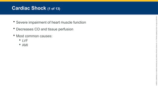 Copyright
©
2023
by
Jones
&
Bartlett
Learning,
LLC,
an
Ascend
Learning
Company
and
the
American
Academy
of
Orthopaedic
Surgeons.
Cardiac Shock (1 of 13)
 Severe impairment of heart muscle function
 Decreases CO and tissue perfusion
 Most common causes:
 LVF
 AMI
 