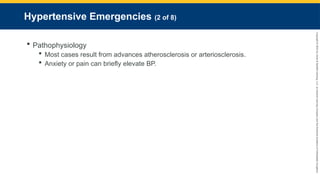 Copyright
©
2023
by
Jones
&
Bartlett
Learning,
LLC,
an
Ascend
Learning
Company
and
the
American
Academy
of
Orthopaedic
Surgeons.
Hypertensive Emergencies (2 of 8)
 Pathophysiology
 Most cases result from advances atherosclerosis or arteriosclerosis.
 Anxiety or pain can briefly elevate BP.
 