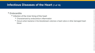 Copyright
©
2023
by
Jones
&
Bartlett
Learning,
LLC,
an
Ascend
Learning
Company
and
the
American
Academy
of
Orthopaedic
Surgeons.
Infectious Diseases of the Heart (1 of 10)
 Endocarditis
 Infection of the inner lining of the heart
 Characterized by endocardium inflammation
 Occurs when bacteria in the bloodstream colonize a heart valve or other damaged heart
tissue
 