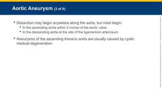 Copyright
©
2023
by
Jones
&
Bartlett
Learning,
LLC,
an
Ascend
Learning
Company
and
the
American
Academy
of
Orthopaedic
Surgeons.
Aortic Aneurysm (3 of 9)
 Dissection may begin anywhere along the aorta, but most begin:
 In the ascending aorta within 2 inches of the aortic valve
 In the descending aorta at the site of the ligamentum arteriosum
 Aneurysms of the ascending thoracic aorta are usually caused by cystic
medical degeneration.
 