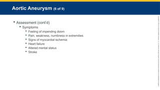 Copyright
©
2023
by
Jones
&
Bartlett
Learning,
LLC,
an
Ascend
Learning
Company
and
the
American
Academy
of
Orthopaedic
Surgeons.
Aortic Aneurysm (6 of 9)
 Assessment (cont’d)
 Symptoms
 Feeling of impending doom
 Pain, weakness, numbness in extremities
 Signs of myocardial ischemia
 Heart failure
 Altered mental status
 Stroke
 