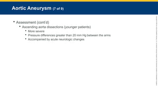 Copyright
©
2023
by
Jones
&
Bartlett
Learning,
LLC,
an
Ascend
Learning
Company
and
the
American
Academy
of
Orthopaedic
Surgeons.
Aortic Aneurysm (7 of 9)
 Assessment (cont’d)
 Ascending aorta dissections (younger patients)
 More severe
 Pressure differences greater than 20 mm Hg between the arms
 Accompanied by acute neurologic changes
 