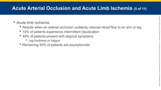 Copyright
©
2023
by
Jones
&
Bartlett
Learning,
LLC,
an
Ascend
Learning
Company
and
the
American
Academy
of
Orthopaedic
Surgeons.
Acute Arterial Occlusion and Acute Limb Ischemia (5 of 11)
 Acute limb ischemia
 Results when an arterial occlusion suddenly reduces blood flow to an arm or leg
 10% of patients experience intermittent claudication
 40% of patients present with atypical symptoms
 Leg tiredness or fatigue
 Remaining 50% of patients are asymptomatic
 