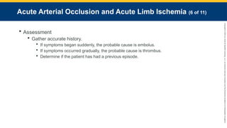 Copyright
©
2023
by
Jones
&
Bartlett
Learning,
LLC,
an
Ascend
Learning
Company
and
the
American
Academy
of
Orthopaedic
Surgeons.
Acute Arterial Occlusion and Acute Limb Ischemia (6 of 11)
 Assessment
 Gather accurate history.
 If symptoms began suddenly, the probable cause is embolus.
 If symptoms occurred gradually, the probable cause is thrombus.
 Determine if the patient has had a previous episode.
 