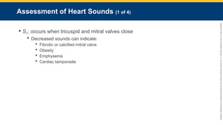 Copyright
©
2023
by
Jones
&
Bartlett
Learning,
LLC,
an
Ascend
Learning
Company
and
the
American
Academy
of
Orthopaedic
Surgeons.
Assessment of Heart Sounds (1 of 4)
 S1: occurs when tricuspid and mitral valves close
 Decreased sounds can indicate:
 Fibrotic or calcified mitral valve
 Obesity
 Emphysema
 Cardiac tamponade
 