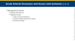 Copyright
©
2023
by
Jones
&
Bartlett
Learning,
LLC,
an
Ascend
Learning
Company
and
the
American
Academy
of
Orthopaedic
Surgeons.
Acute Arterial Occlusion and Acute Limb Ischemia (11 of 11)
 Management (cont’d)
 Monitor the five Ps.
 Refusal of care
 Urge to accept assistance
 Contact medical direction for advice
 Document refusal
 