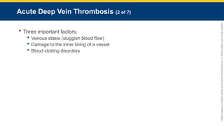 Copyright
©
2023
by
Jones
&
Bartlett
Learning,
LLC,
an
Ascend
Learning
Company
and
the
American
Academy
of
Orthopaedic
Surgeons.
Acute Deep Vein Thrombosis (2 of 7)
 Three important factors:
 Venous stasis (sluggish blood flow)
 Damage to the inner lining of a vessel
 Blood clotting disorders
 