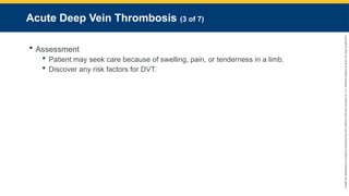 Copyright
©
2023
by
Jones
&
Bartlett
Learning,
LLC,
an
Ascend
Learning
Company
and
the
American
Academy
of
Orthopaedic
Surgeons.
Acute Deep Vein Thrombosis (3 of 7)
 Assessment
 Patient may seek care because of swelling, pain, or tenderness in a limb.
 Discover any risk factors for DVT.
 
