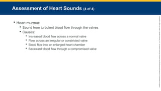 Copyright
©
2023
by
Jones
&
Bartlett
Learning,
LLC,
an
Ascend
Learning
Company
and
the
American
Academy
of
Orthopaedic
Surgeons.
Assessment of Heart Sounds (4 of 4)
 Heart murmur:
 Sound from turbulent blood flow through the valves
 Causes:
 Increased blood flow across a normal valve
 Flow across an irregular or constricted valve
 Blood flow into an enlarged heart chamber
 Backward blood flow through a compromised valve
 