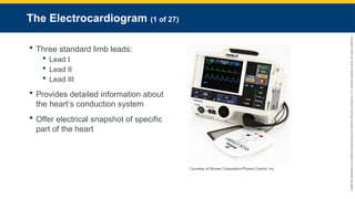 Copyright
©
2023
by
Jones
&
Bartlett
Learning,
LLC,
an
Ascend
Learning
Company
and
the
American
Academy
of
Orthopaedic
Surgeons.
The Electrocardiogram (1 of 27)
 Three standard limb leads:
 Lead I
 Lead II
 Lead III
 Provides detailed information about
the heart’s conduction system
 Offer electrical snapshot of specific
part of the heart
Courtesy of Stryker Corporation/Physio-Control, Inc.
 