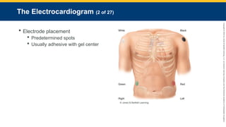 Copyright
©
2023
by
Jones
&
Bartlett
Learning,
LLC,
an
Ascend
Learning
Company
and
the
American
Academy
of
Orthopaedic
Surgeons.
The Electrocardiogram (2 of 27)
 Electrode placement
 Predetermined spots
 Usually adhesive with gel center
© Jones & Bartlett Learning.
 