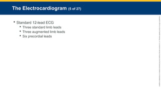 Copyright
©
2023
by
Jones
&
Bartlett
Learning,
LLC,
an
Ascend
Learning
Company
and
the
American
Academy
of
Orthopaedic
Surgeons.
The Electrocardiogram (5 of 27)
 Standard 12-lead ECG
 Three standard limb leads
 Three augmented limb leads
 Six precordial leads
 