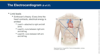 Copyright
©
2023
by
Jones
&
Bartlett
Learning,
LLC,
an
Ascend
Learning
Company
and
the
American
Academy
of
Orthopaedic
Surgeons.
The Electrocardiogram (6 of 27)
 Limb leads
 Einthoven’s theory: Every time the
heart contracts, electrical energy is
emitted
 Lead I—attached to right and left
arms
 Lead II—runs between right arm
and left leg
 Lead III—runs between left arm
and left leg
Reproduced from 12-Lead ECG: The Art of Interpretation, courtesy
of Tomas B. Garcia, MD.
 