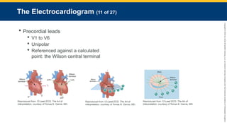 Copyright
©
2023
by
Jones
&
Bartlett
Learning,
LLC,
an
Ascend
Learning
Company
and
the
American
Academy
of
Orthopaedic
Surgeons.
The Electrocardiogram (11 of 27)
 Precordial leads
 V1 to V6
 Unipolar
 Referenced against a calculated
point: the Wilson central terminal
Reproduced from 12-Lead ECG: The Art of
Interpretation, courtesy of Tomas B. Garcia, MD.
Reproduced from 12-Lead ECG: The Art of
Interpretation, courtesy of Tomas B. Garcia, MD.
Reproduced from 12-Lead ECG: The Art of
Interpretation, courtesy of Tomas B. Garcia, MD.
 