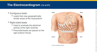 Copyright
©
2023
by
Jones
&
Bartlett
Learning,
LLC,
an
Ascend
Learning
Company
and
the
American
Academy
of
Orthopaedic
Surgeons.
The Electrocardiogram (13 of 27)
 Contiguous leads
 Leads that view geographically
similar areas of the myocardium
 Right-sided leads
 Used to evaluate the electrical
activity of the right ventricle
 Precordial leads are placed on the
right anterior thorax
© Jones & Bartlett Learning
 