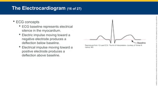 Copyright
©
2023
by
Jones
&
Bartlett
Learning,
LLC,
an
Ascend
Learning
Company
and
the
American
Academy
of
Orthopaedic
Surgeons.
The Electrocardiogram (16 of 27)
 ECG concepts
 ECG baseline represents electrical
silence in the myocardium.
 Electric impulse moving toward a
negative electrode produces a
deflection below baseline.
 Electrical impulse moving toward a
positive electrode produces a
deflection above baseline.
Reproduced from 12-Lead ECG: The Art of Interpretation, courtesy of Tomas B.
Garcia, MD.
 