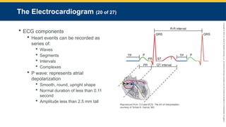 Copyright
©
2023
by
Jones
&
Bartlett
Learning,
LLC,
an
Ascend
Learning
Company
and
the
American
Academy
of
Orthopaedic
Surgeons.
The Electrocardiogram (20 of 27)
 ECG components
 Heart events can be recorded as
series of:
 Waves
 Segments
 Intervals
 Complexes
 P wave: represents atrial
depolarization
 Smooth, round, upright shape
 Normal duration of less than 0.11
second
 Amplitude less than 2.5 mm tall
Reproduced from 12-Lead ECG: The Art of Interpretation,
courtesy of Tomas B. Garcia, MD.
 