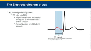 Copyright
©
2023
by
Jones
&
Bartlett
Learning,
LLC,
an
Ascend
Learning
Company
and
the
American
Academy
of
Orthopaedic
Surgeons.
The Electrocardiogram (21 of 27)
 ECG components (cont’d)
 PR interval (PRI):
 Represents the time required for
an impulse to traverse the atria
and AV junction
 Normal duration of 0.12 to 0.20
seconds
Reproduced from 12-Lead ECG: The Art of Interpretation,
courtesy of Tomas B. Garcia, MD.
 