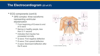 Copyright
©
2023
by
Jones
&
Bartlett
Learning,
LLC,
an
Ascend
Learning
Company
and
the
American
Academy
of
Orthopaedic
Surgeons.
The Electrocardiogram (23 of 27)
 ECG components (cont’d)
 QRS complex: three waveforms
representing ventricular
depolarization
 From beginning of Q wave to end
of S wave
 Narrow in healthy people, less
than 0.11 second
 Indicates that impulse has
proceeded normally
 Q wave: First negative deflection
 R wave: First upward deflection
 S wave: Downward deflection after
the R wave © Jones & Bartlett Learning.
 