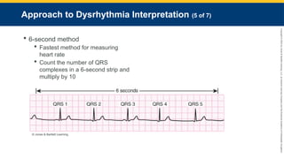 Copyright
©
2023
by
Jones
&
Bartlett
Learning,
LLC,
an
Ascend
Learning
Company
and
the
American
Academy
of
Orthopaedic
Surgeons.
Approach to Dysrhythmia Interpretation (5 of 7)
 6-second method
 Fastest method for measuring
heart rate
 Count the number of QRS
complexes in a 6-second strip and
multiply by 10
© Jones & Bartlett Learning.
 
