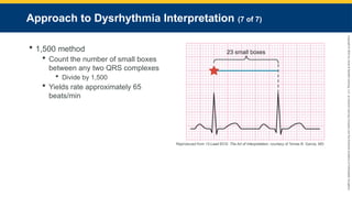 Copyright
©
2023
by
Jones
&
Bartlett
Learning,
LLC,
an
Ascend
Learning
Company
and
the
American
Academy
of
Orthopaedic
Surgeons.
Approach to Dysrhythmia Interpretation (7 of 7)
 1,500 method
 Count the number of small boxes
between any two QRS complexes
 Divide by 1,500
 Yields rate approximately 65
beats/min
Reproduced from 12-Lead ECG: The Art of Interpretation, courtesy of Tomas B. Garcia, MD.
 