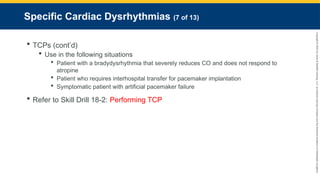 Copyright
©
2023
by
Jones
&
Bartlett
Learning,
LLC,
an
Ascend
Learning
Company
and
the
American
Academy
of
Orthopaedic
Surgeons.
Specific Cardiac Dysrhythmias (7 of 13)
 TCPs (cont’d)
 Use in the following situations
 Patient with a bradydysrhythmia that severely reduces CO and does not respond to
atropine
 Patient who requires interhospital transfer for pacemaker implantation
 Symptomatic patient with artificial pacemaker failure
 Refer to Skill Drill 18-2: Performing TCP
 