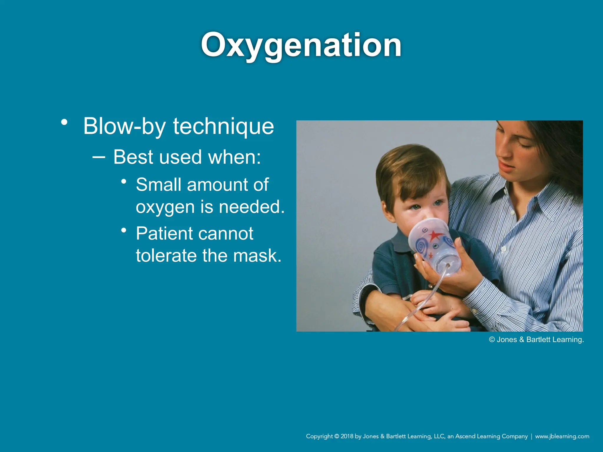 Oxygenation
• Blow-by technique
− Best used when:
• Small amount of
oxygen is needed.
• Patient cannot
tolerate the mask.
© Jones & Bartlett Learning.
 