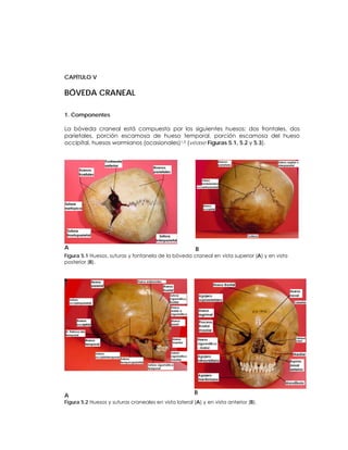 CAPÍTULO V
BÓVEDA CRANEAL
1. Componentes
La bóveda craneal está compuesta por los siguientes huesos: dos frontales, dos
parietales, porción escamosa de hueso temporal, porción escamosa del hueso
occipital, huesos wormianos (ocasionales)1,2 (véase Figuras 5.1, 5.2 y 5.3).
A B
Figura 5.1 Huesos, suturas y fontanela de la bóveda craneal en vista superior (A) y en vista
posterior (B).
A
B
Figura 5.2 Huesos y suturas craneales en vista lateral (A) y en vista anterior (B).
 