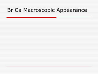 Br Ca Macroscopic Appearance
 