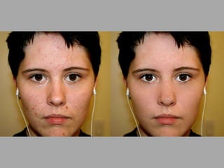 Image Editing Before After