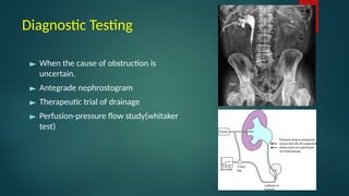 984. Percutaneous Nephrostomy (1).pptxedrrrrrrrr | PPTX