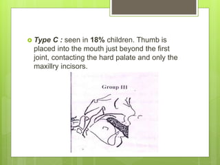  Type C : seen in 18% children. Thumb is
placed into the mouth just beyond the first
joint, contacting the hard palate and only the
maxillry incisors.
 