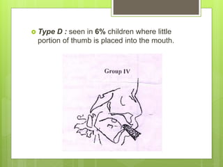  Type D : seen in 6% children where little
portion of thumb is placed into the mouth.
 